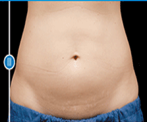 Simple Method Melts Belly Fat